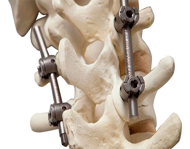 Нейрохирургия